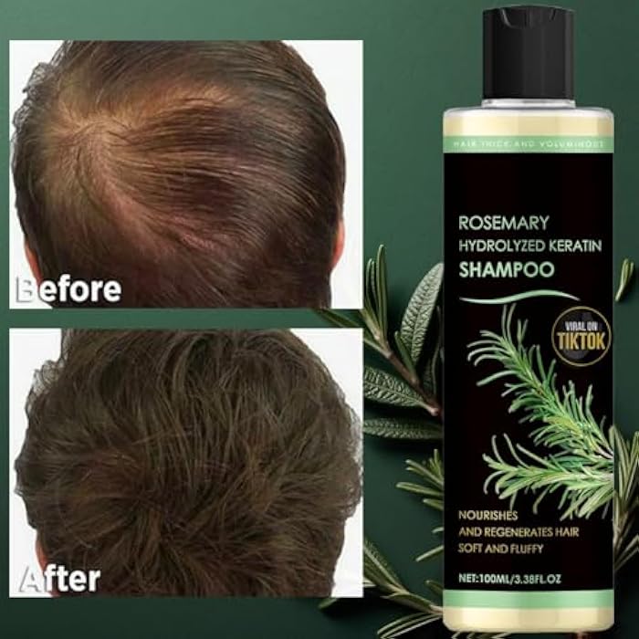 Rosemary Biotin Shampoo for Hair Growth - Sulfate-Free Volumizing Shampoo for Thinning Hair, Dry & Damaged Hair - Vegan, Color Safe with Keratin - Men & Women (2) - Image 2