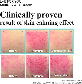 LAB FOR YOU MultiEx AC Cream Spot treatment Korean cosmetics blemish relief teatree leaf oil 20ml07 floz - Image 2