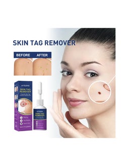 Jaysuing Women Skin Tag Remover 20ml KSA | Riyadh, Jeddah