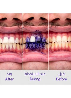 HiSmile v34 Teeth Color Corrector Serum (Viral) 30ml  - Image 4