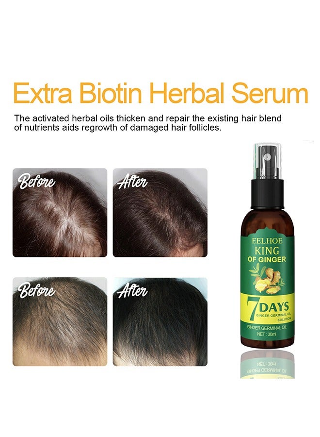 Ginger Germinal oil- Hair Growth Spray, Rapid Growth Hair Treatment 7 Day Hair Growth Serum Essence Oil Regrow, Ginger Essential Oil Stop Hair Loss Hair, Thinning Treatment Hair Growth Oil For Women &