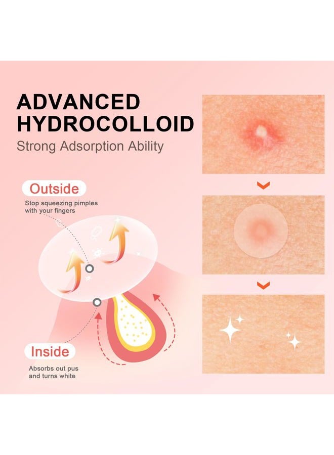 AVJONE Pimple Patches for Face(144 Patches), Hydrocolloid Acne Patches with Tea Tree Oil, pimple stickers for Breakouts, Absorbs Zit, Invisible Spot Cover and Blemish - Image 2