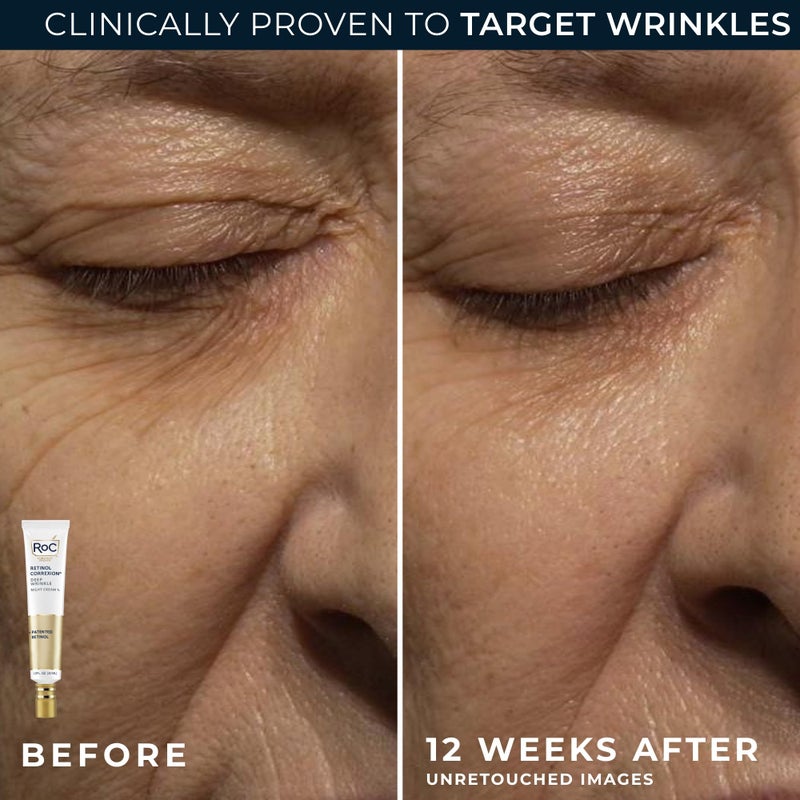 RoC Retinol Correxion Value Set Duo, Deep Wrinkle Anti-Aging Night Face Cream + Under Eye Cream for Dark Circles & Puffiness - Retinol Eye Care - Image 5