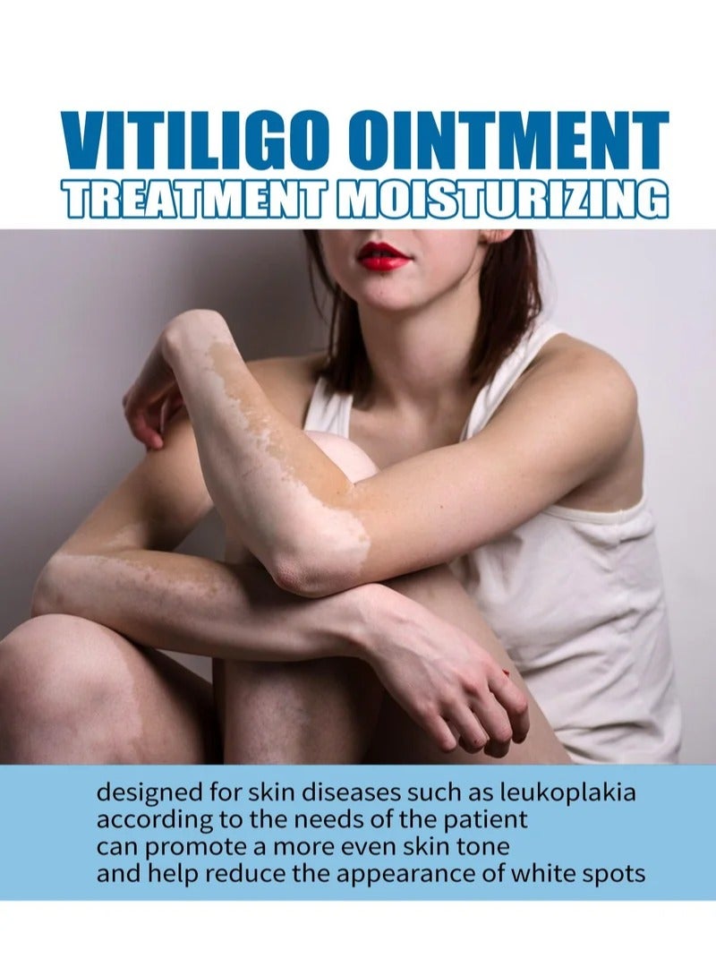 SOUTH MOON VitiligoTreatment Ointment 20g  - Image 3