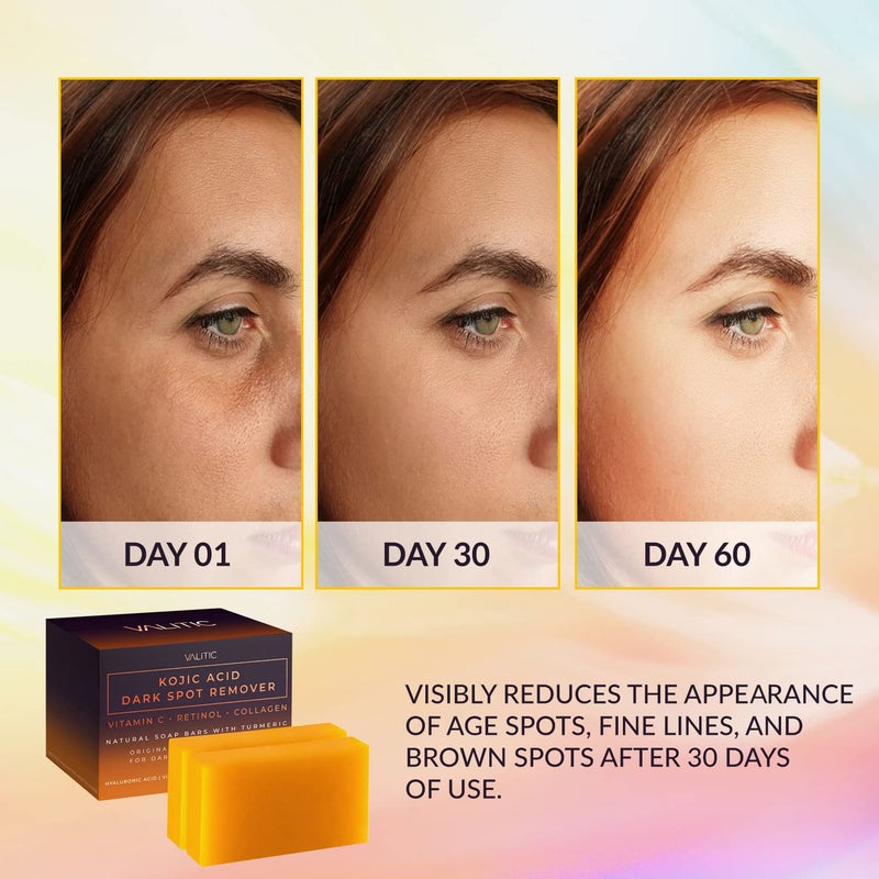 VALITIC Kojic Acid Dark Spot Remover Soap Bar with Vitamin C,Retinol,Collagen,Turmeric - Original Japanese Complex Hyaluronic Acid,E,Shea Butter,Castile Oil (2 Pack) With Holder,Pack of 3,3.5 ounces - Image 2