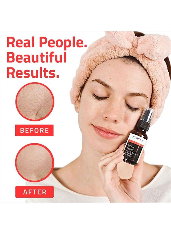 Yeouth Retinol Serum for Face with Hyaluronic Acid, Hydrating Night Serum for Face, Retinol for Acne, Wrinkle & Dark Spots, Anti Aging Serum, Retinol for Face, Skin Care Face Serum for Men & Women by YEOUTH - Image 4