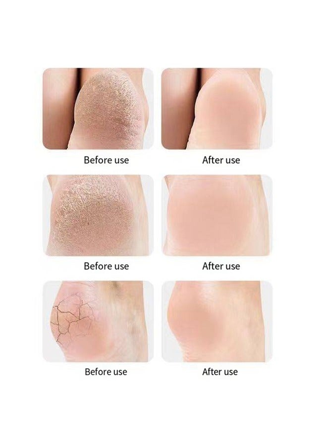 Plantar Fasciitis Socks with Arch Support Heel Protector for Plantar Fasciitis and Heel Pain Relief - Image 5