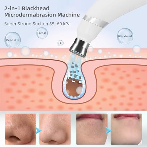 IeBilif Diamond Microdermabrasion Machine, 3 Modes Diamond Microdermabrasion Dermabrasion Machine for Blackhead Removal, Professional Portable Home Travel Microdermabrasion Device - Image 3