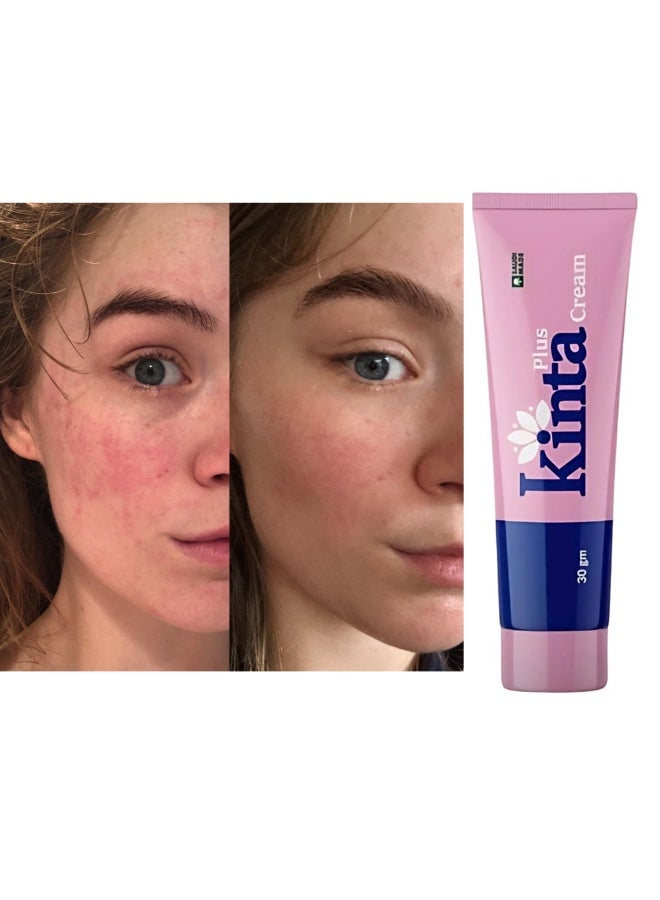كنتا كريم كينتا بلس للمناطق الحساسة وتفتيح البقع الداكنة، 30 غرام - Image 3