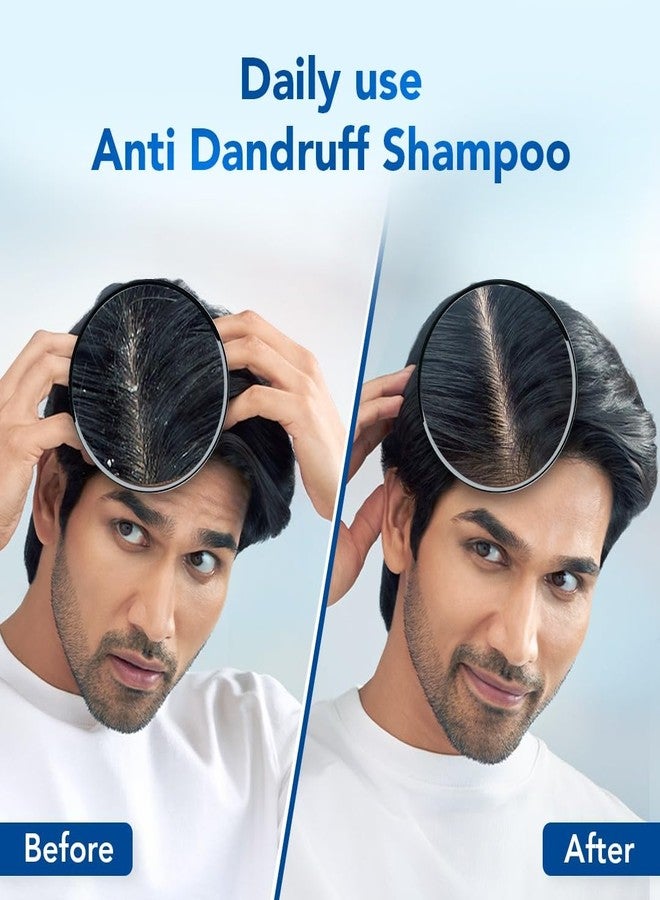 Scalpe Pro Daily Anti-Dandruff Shampoo | Removes Dandruff from Source | Helps with Itching, Irritation & Redness accompanying Dandruff | Scalpe Science | Climbazole & ZPTO Formulation | Strong & Smooth Hair | Daily Use | Dermatologically Tested Solution | For Women & Men | 200ml | Pack of 4 - Image 2