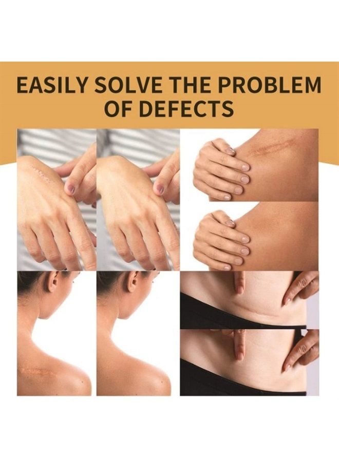 Tattoo Cover Up Sticker,2 Boxes Scar Cover Stickers Ultra Thin Patch Tattoo Concealing Tape Breathable and Waterproof Skin Concealing Tape Tattoo Flaw Conceal Sticker Patch Scar Cover Sticker