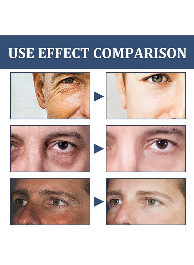إيست مون كريم الوجه - مرطب الوجه للرجال 6 في 1 لأكياس تحت العين ، كريم الوجه المرطب للرجال ، كريم الوجه المغذي للبشرة والتجاعيد للبقع الداكنة ، الخطوط الدقيقة ، الغربان أقدام العين 50 مل - Image 5