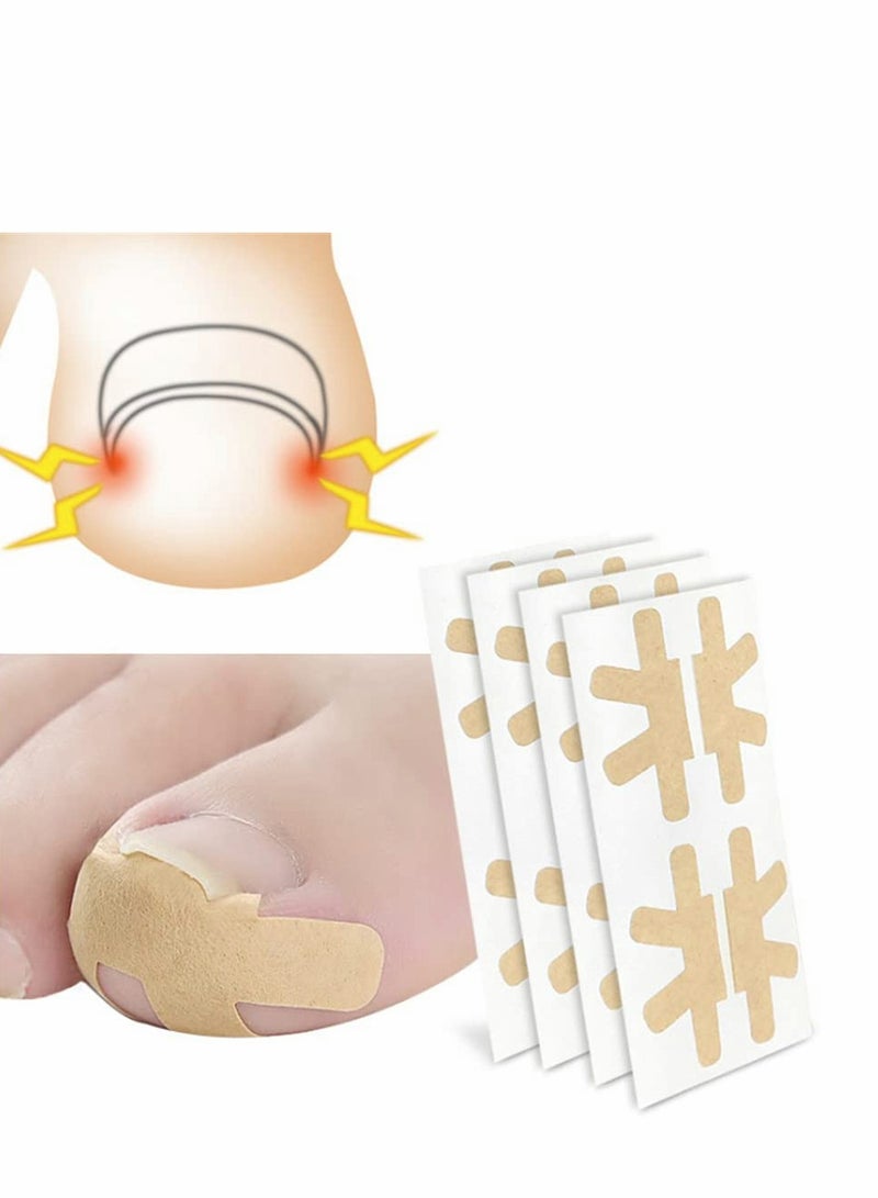 KASTWAVE لاصقات تصحيح الأظافر المنغرسة، شرائط مصححة للأظافر المنغرسة بدون غراء، لاصقات تصحيح الأظافر بدون ألم، أداة علاج الأظافر المهنية للعناية بالقدم (60 قطعة) - Image 1