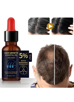 lansiyi Hair Growth Essenyial Oil - Biotin Hair Growth Serum and 5% Minoxidil Treatment for Stronger, Fuller, Longer Hair - Natural Hair Thickening Treatment - Stops Hair Loss and Thinning for Men and Women  - Image 1