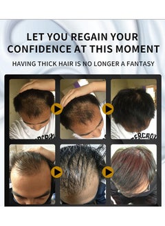 lansiyi Hair Growth Essenyial Oil - Biotin Hair Growth Serum and 5% Minoxidil Treatment for Stronger, Fuller, Longer Hair - Natural Hair Thickening Treatment - Stops Hair Loss and Thinning for Men and Women  - Image 4
