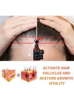 lansiyi Hair Growth Essenyial Oil - Biotin Hair Growth Serum and 5% Minoxidil Treatment for Stronger, Fuller, Longer Hair - Natural Hair Thickening Treatment - Stops Hair Loss and Thinning for Men and Women  - Image 2
