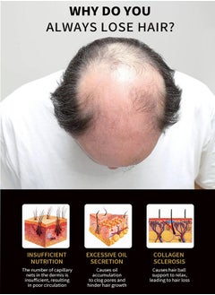 lansiyi Hair Growth Essenyial Oil - Biotin Hair Growth Serum and 5% Minoxidil Treatment for Stronger, Fuller, Longer Hair - Natural Hair Thickening Treatment - Stops Hair Loss and Thinning for Men and Women  - Image 5