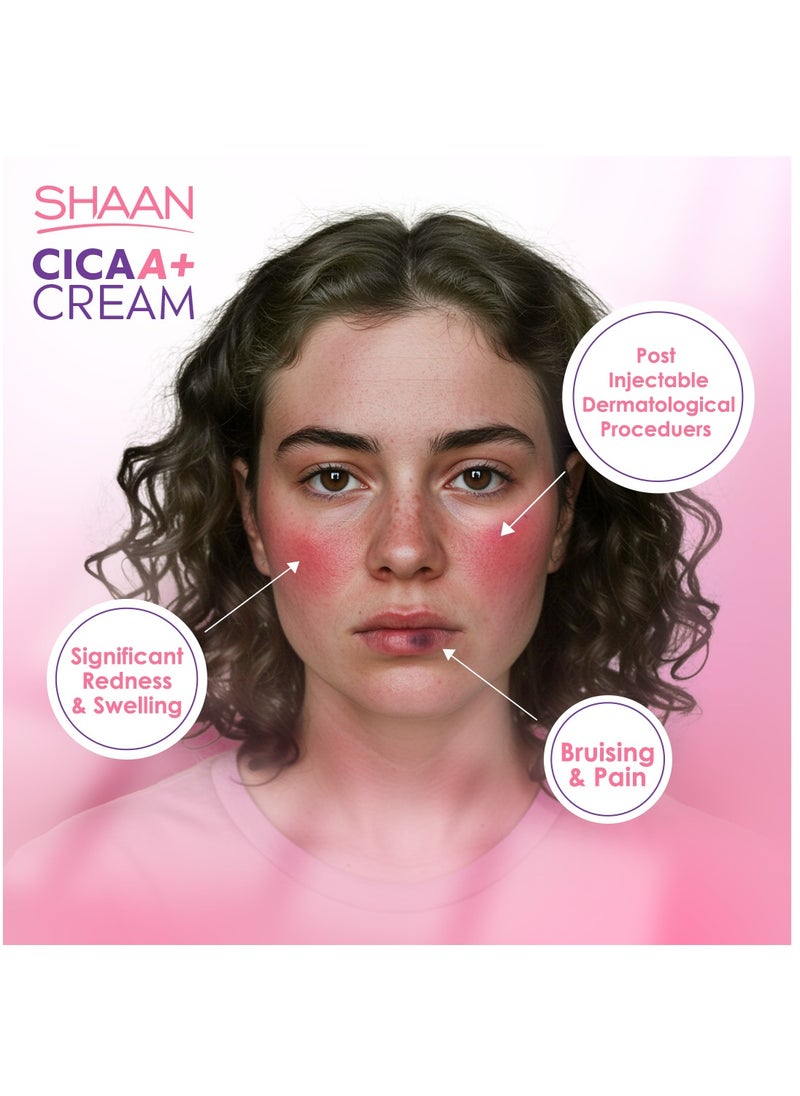 Shaan CICA ARNICA+ Cream 40gm