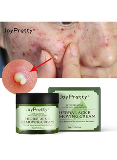 JoyPretty Herbal Acne Treatment Face Cream, Acne Spot Treatment For Face And Acne Dots, Natural Cystic Acne Treatment, For All Skin Types, Premium Acne Scar Cream And Pimple Remover 50G  - Image 2
