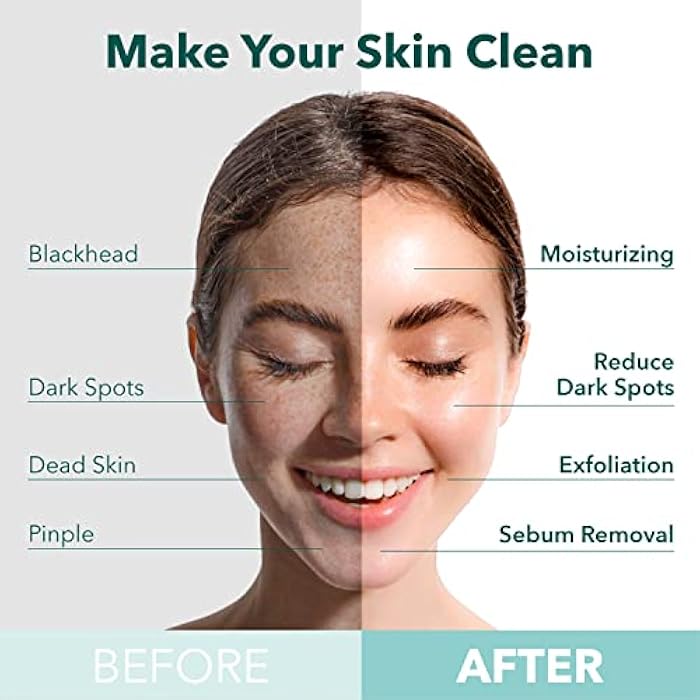 Purederm Deep Purifying Yellow O2 Bubble Mask Turmeric (5 Pack) – Bubble Face Sheet Mask for Purifying & Vitalizing - Image 3