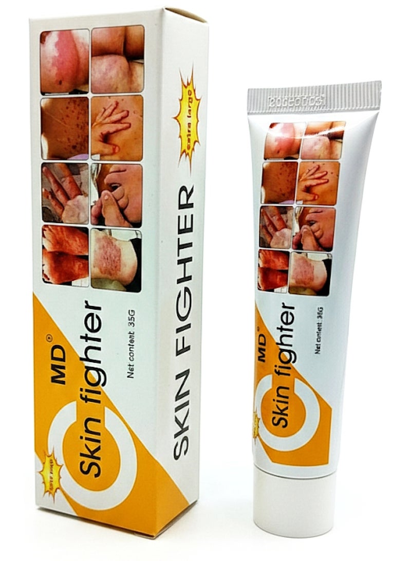 MD Skin Fighter Cream for Skin Allergies or Fungus [35g].
