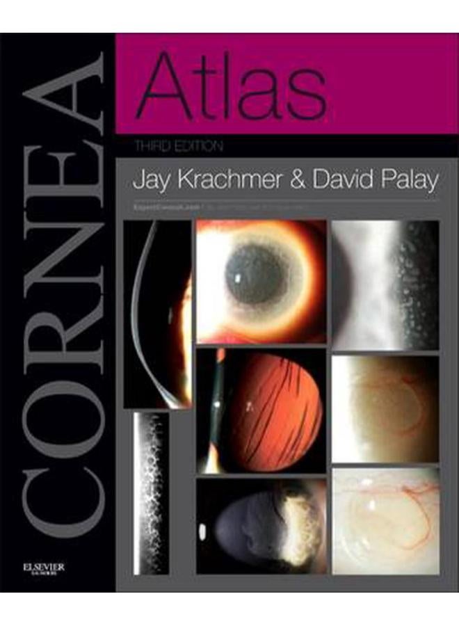 Cornea Atlas: Expert Consult - Online and Print
