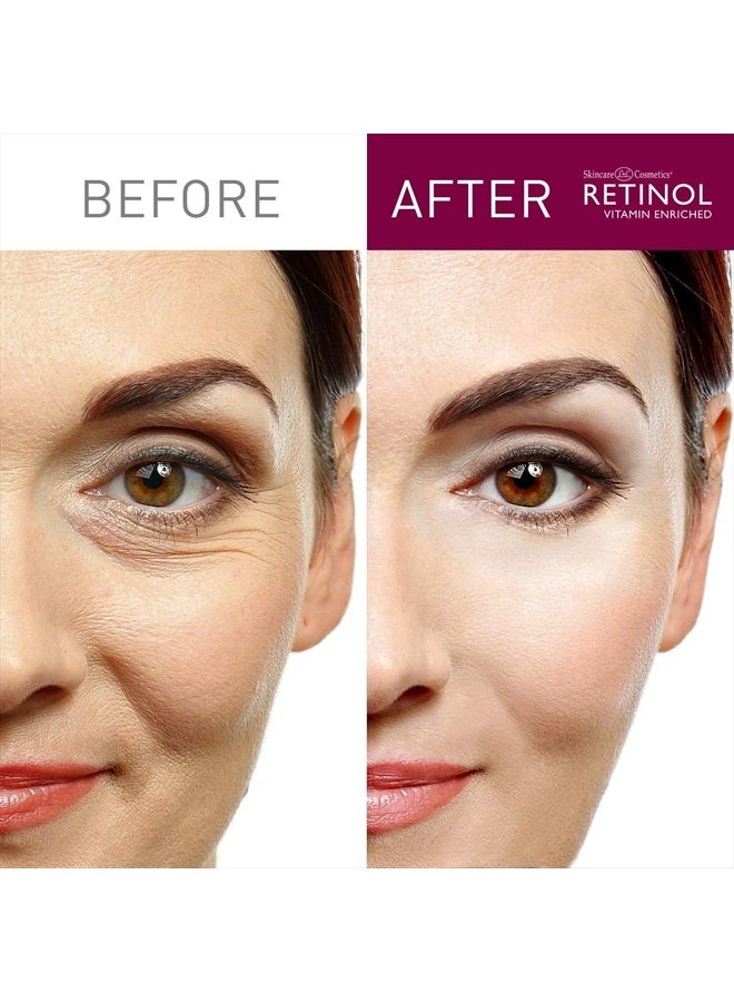 RETINOL مُضيء البشرة بالريتينول - العلامة التجارية الأصلية للريتينول - مصحح لون البشرة يُنعّم ويُجدّد الوجه للحصول على إشراقة صحية - يُقلل من الخطوط الدقيقة والتجاعيد مع مستخلصات النباتات والفواكه، فيتامين A وC وE - Image 4