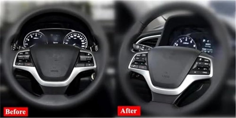 DEMULAX Car Cruise Control Button for Hyundai - Image 3