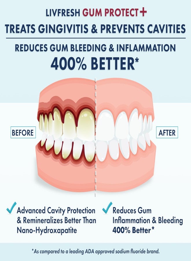 LIVFRESH Gum Protect Toothpaste Gel, Gingivitis Treatment, Reduces Bleeding, Swollen Gums 400% Better, Cavity Protection, Remineralizes Teeth, Whitens Teeth, Stannous Fluoride (1.75 Ounce (Pack of 1 - Image 2