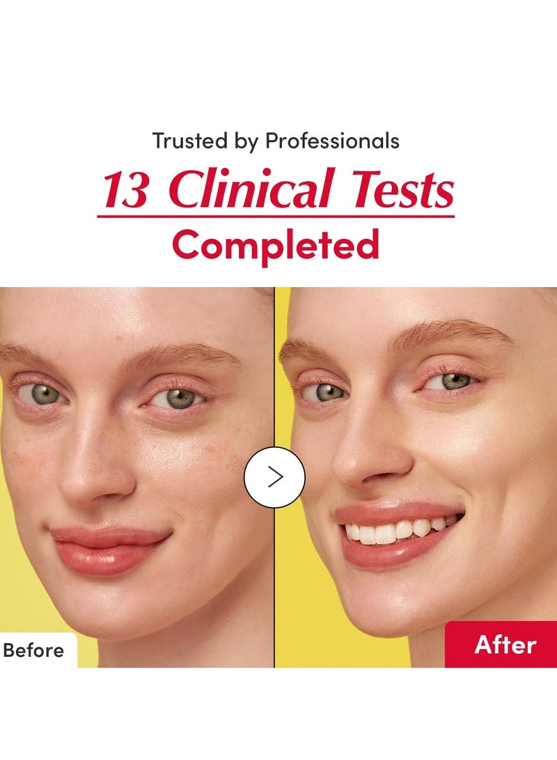 إيكوالبيري سيروم فيتامين إيلوميناتينج – سيروم فيتامين سي المضيء مع النياسيناميد | يقوي حاجز الجلد | يرطب باستخدام السيراميد وحمض الهيالورونيك، 1.01 أونصة / 30 مل - Image 5