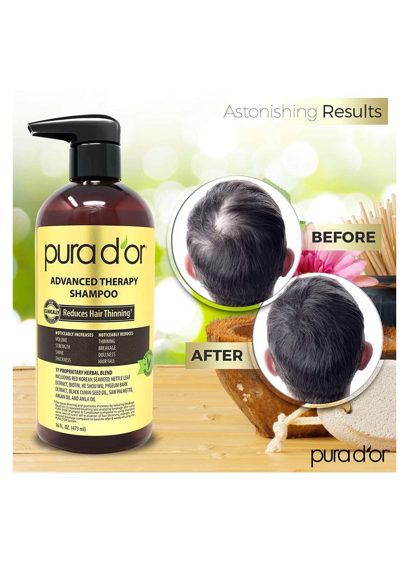 Pura Dor - PURA D'OR Advanced Therapy Shampoo (16oz) Reduces Hair Thinning & Increases Volume, No Sulfate, Biotin Shampoo Infused with Argan Oil, Aloe Vera for All Hair Types, Men & Women - Image 1