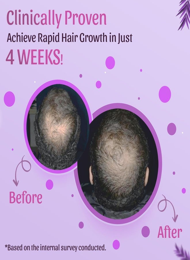 Nimson Hair Nourishment Combo – Rosemary Shampoo (250ml) + Hair Growth Oil (150ml) | Reduces Hair Fall, Strengthens Roots & Boosts Shine | For Men & Women - Image 3