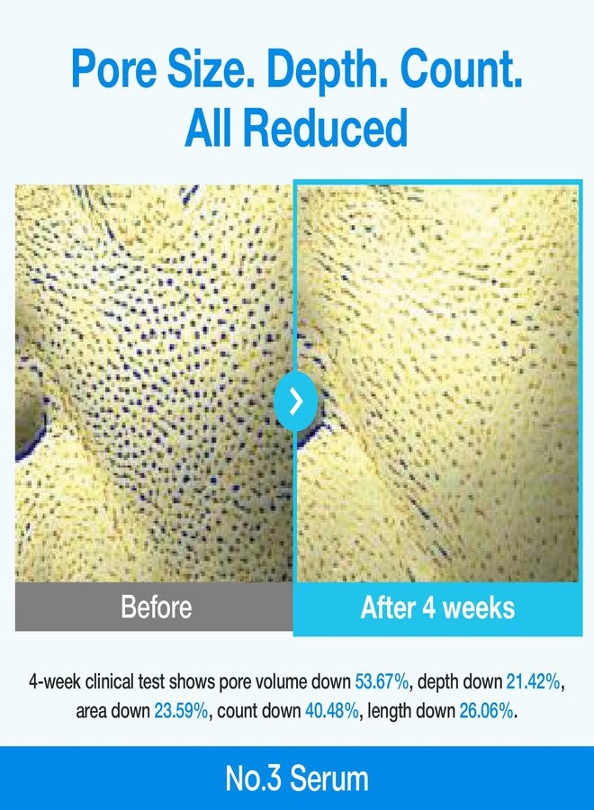 numbuzin سيروم نونبوزين رقم 3 | سيروم البيو-ريتينول الأزرق لتقليل المسام | شد، وتماسك، العناية بالبشرة الكورية | نياسيناميد، ببتيد، حمض الساليسيليك (BHA) | ريتينول سهل الاستخدام للمبتدئين | 1.01 أونصة سائلة - Image 3