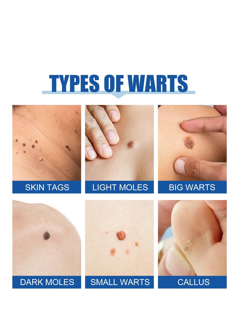 EELHOE Nevus And Wart Removal Cream 10 Ml - Image 3