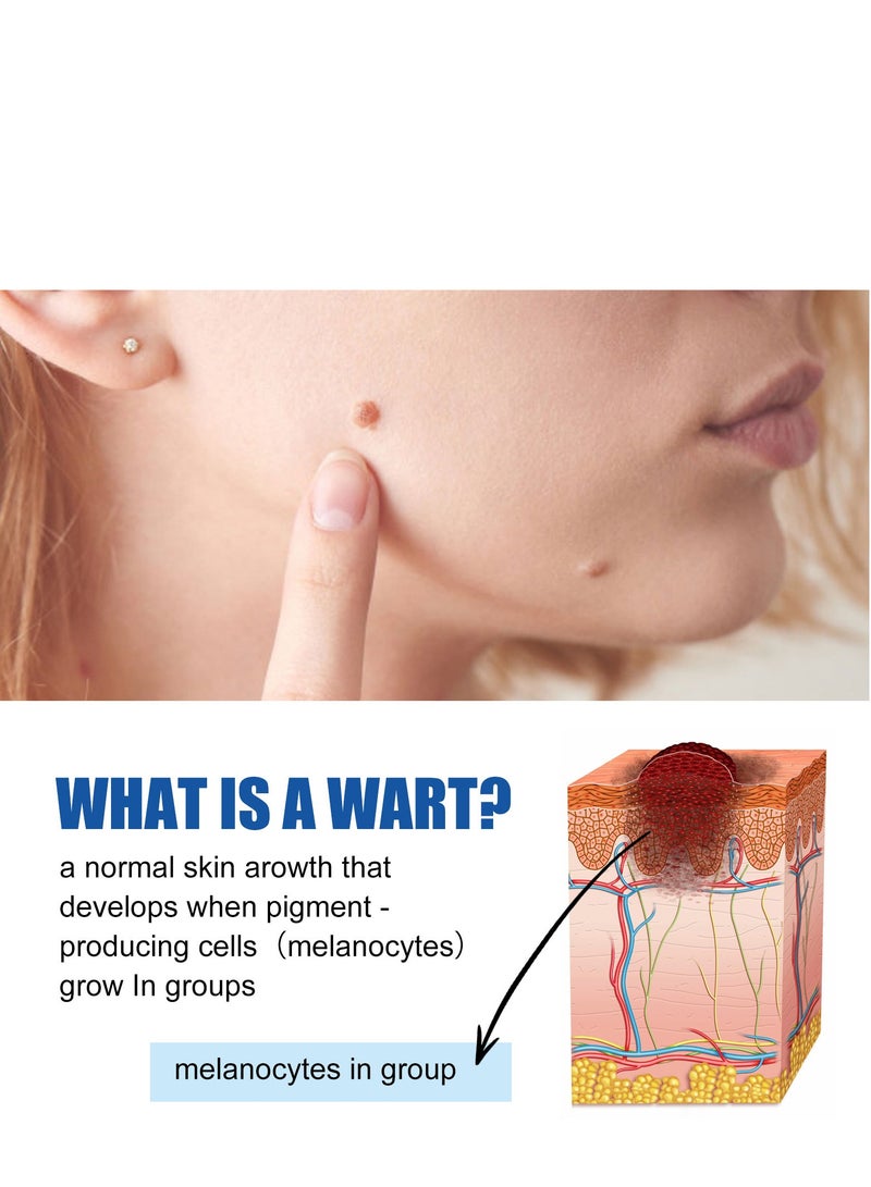 EELHOE Nevus And Wart Removal Cream 10 Ml - Image 4