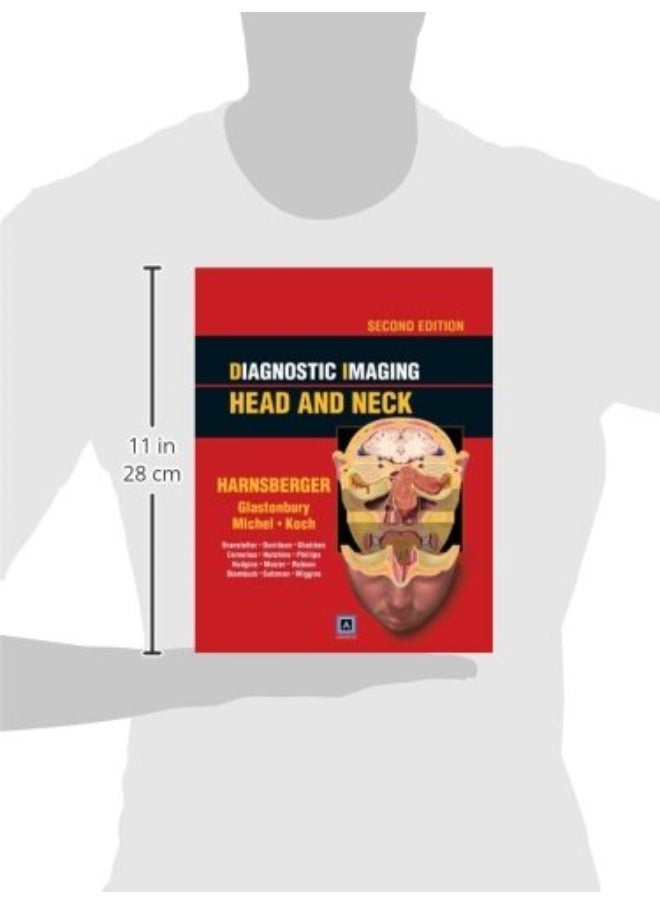 null - Diagnostic Imaging: Head and Neck: Published by Amirsys - Image 1