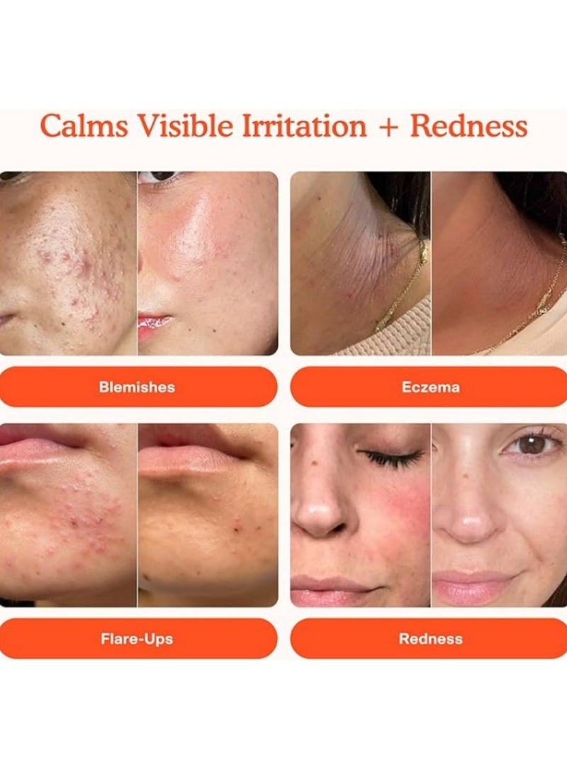 TOWER 28 Sos Daily Rescue Facial Spray For Sensitive Skin, Hypochlorous Acid Spray Helps Reduce Redness And Breakouts, Full Size Toner For Face, 4 Fl Oz - Image 2