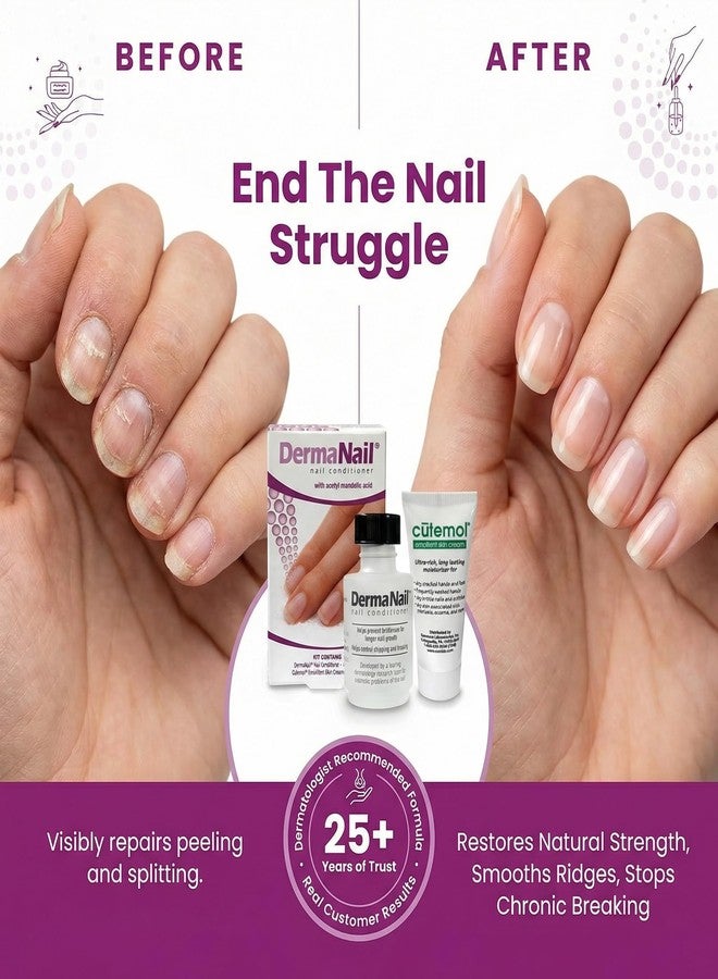 DermaNail Nail Strengthener & Cuticle Cream Set - Fingernail Care Kit with Liquid Nail Strengthener & Cutemol Cream (11.5g Sample) Healthy Growth - Repair for Brittle, Damaged, Thin, & Peeling Nails - Image 2