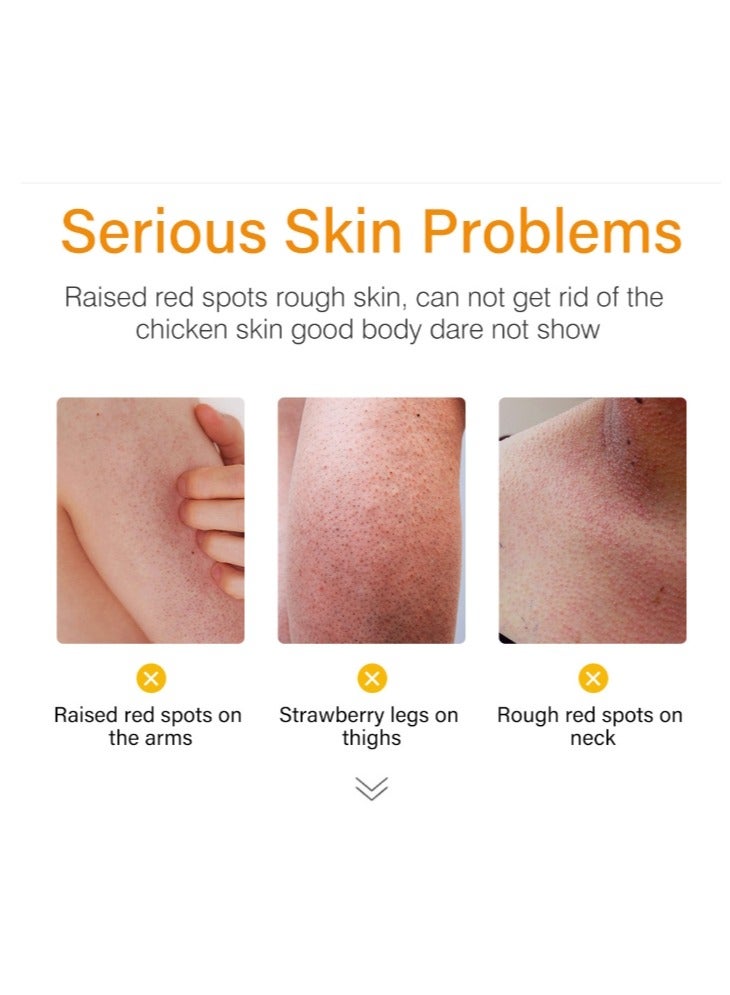 MOOYAM Strawberry Legs Treatment For Women Body Serum Strawberry Legs Treatment For Women Exfoliating Body Serum Chicken Skin Treatment Body Serum Moisturizing Cream For Rough and Bumpy Dry Skin 120ml - Image 2