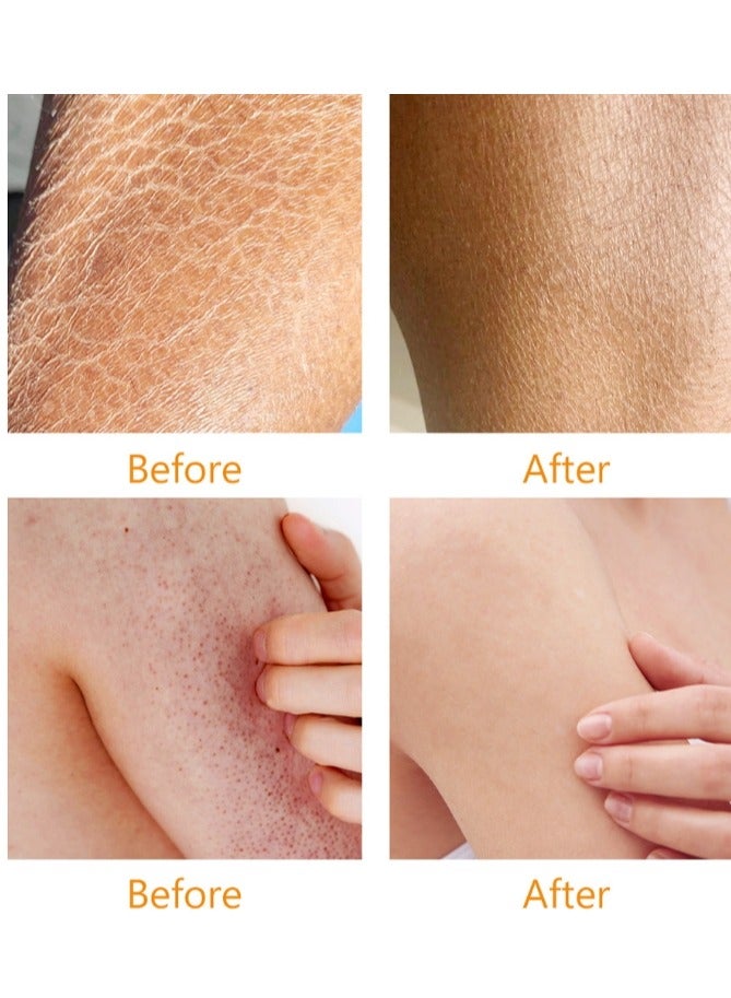 MOOYAM Strawberry Legs Treatment For Women Body Serum Strawberry Legs Treatment For Women Exfoliating Body Serum Chicken Skin Treatment Body Serum Moisturizing Cream For Rough and Bumpy Dry Skin 120ml - Image 5