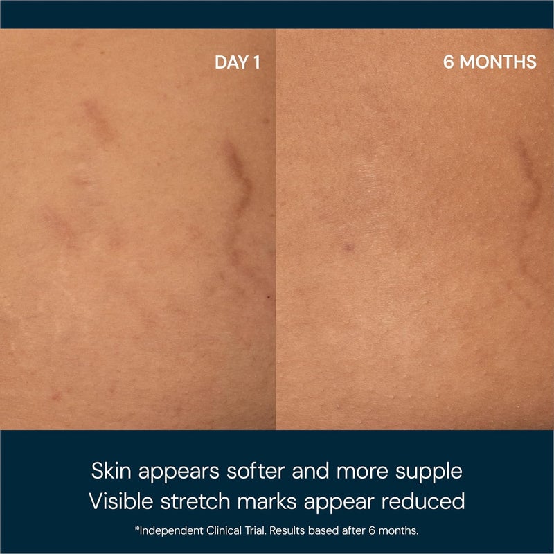 Elemis Japanese Camellia Body Oil Blend - 100 ml Moisturizing Body Oil - Image 2