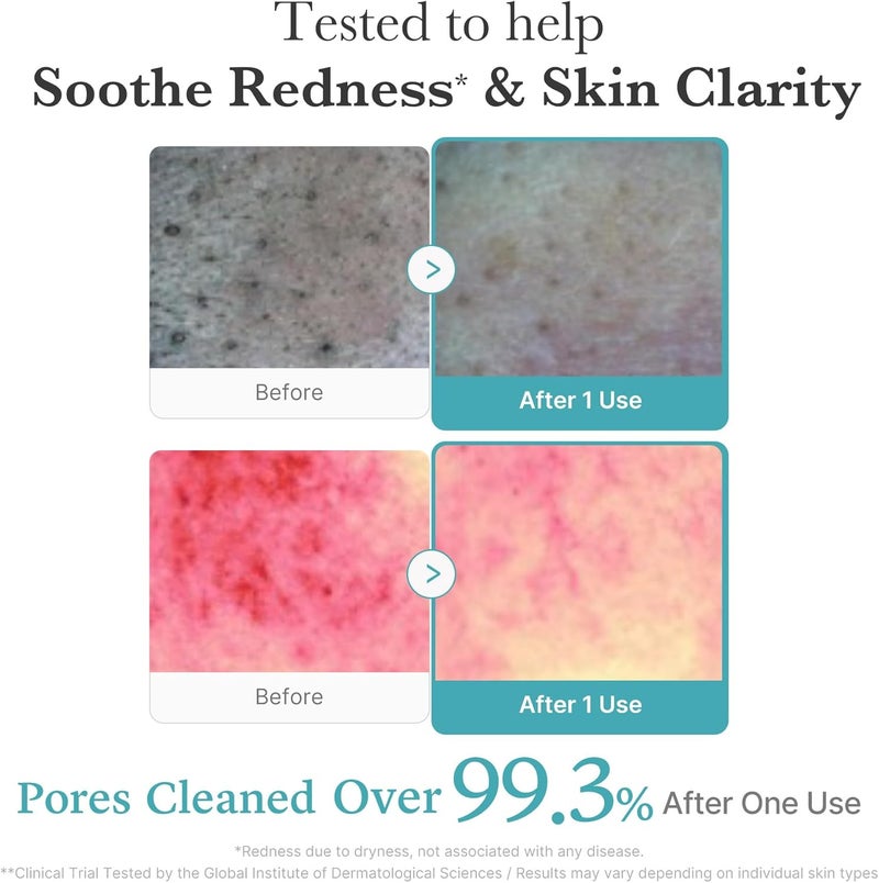 Medicube منظف رغوي بتركيبة حمض الأزيليك مع حلوى الجيلي للبشرة المعرضة لحب الشباب (120 جرام) - Image 4