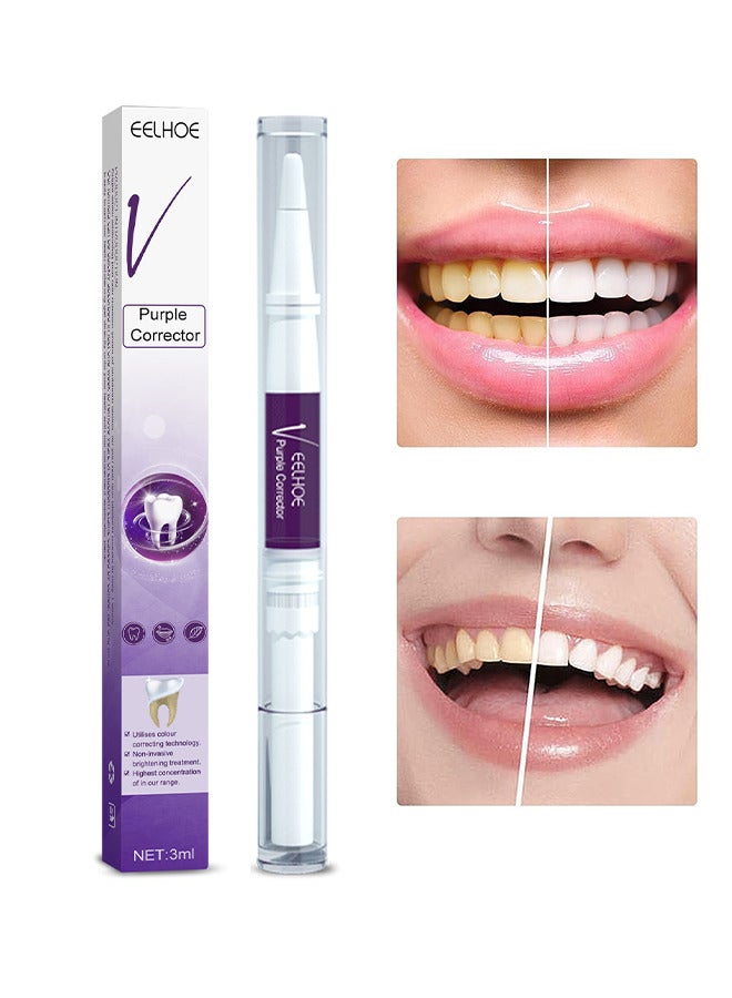 EELHOE Purple Teeth Whitening Pen, Effective, Painless, No Sensitivity, Travel-Friendly, Tooth Stain Remover and Coffee Stain Remover - Image 1