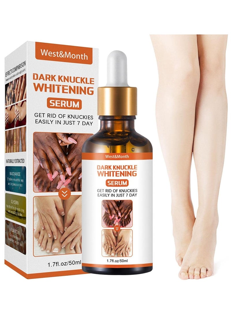 West&Month Skin Whitening Serum, Dark Knuckle Whitening Cream, Dark Knuckle Whitening Serum, Dark Knuckle Whitening Lotion Removing Dark Ankle Fingers - Image 2