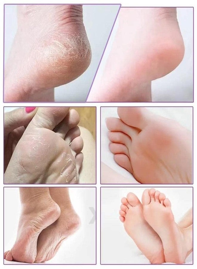 Lavender Exfoliating Foot Peel Mask for Dead Skin & Callus - Image 3