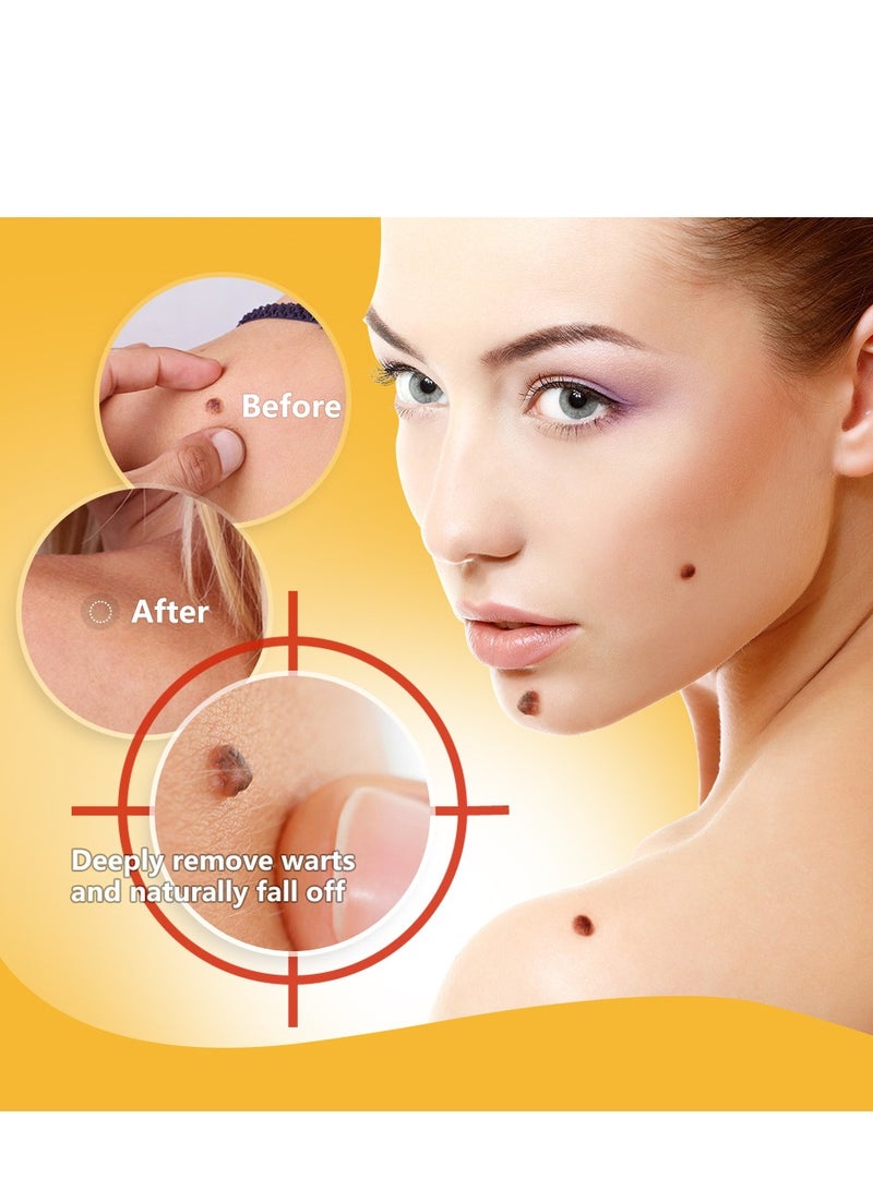 سوميفون مرهم إزالة الثآليل بسم النحل لإزالة الثآليل والشامات وتنعيم البشرة - Image 3