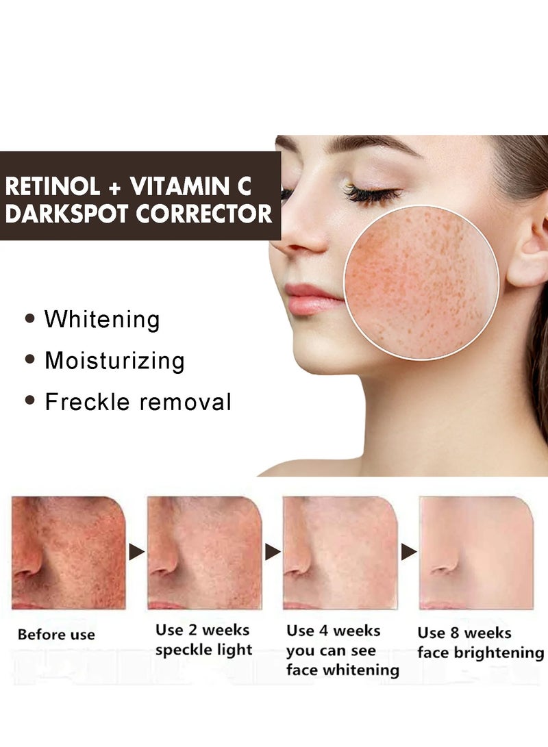 EELHOE Whitening Freckle Cream Remove Dark Spot Correcting Melasma Melanin Moisturizing Skin Improve Dullness Brighten Face Care Cream - Image 4
