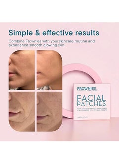 Frownies The Original Wrinkle Patch Facial Patches 144 Patches, Non Invasive Wrinkle Smoothers for Corners of Eyes and Mouth, Anti Wrinkle Patches  - Image 5