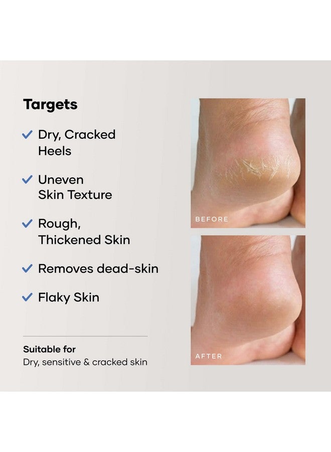 Cureskin Foot Care Cream for Cracked Heels | Repairs, Softens, and Exfoliates | Foot Cream for Women and Men, 50 g (Pack of 1) - Image 5