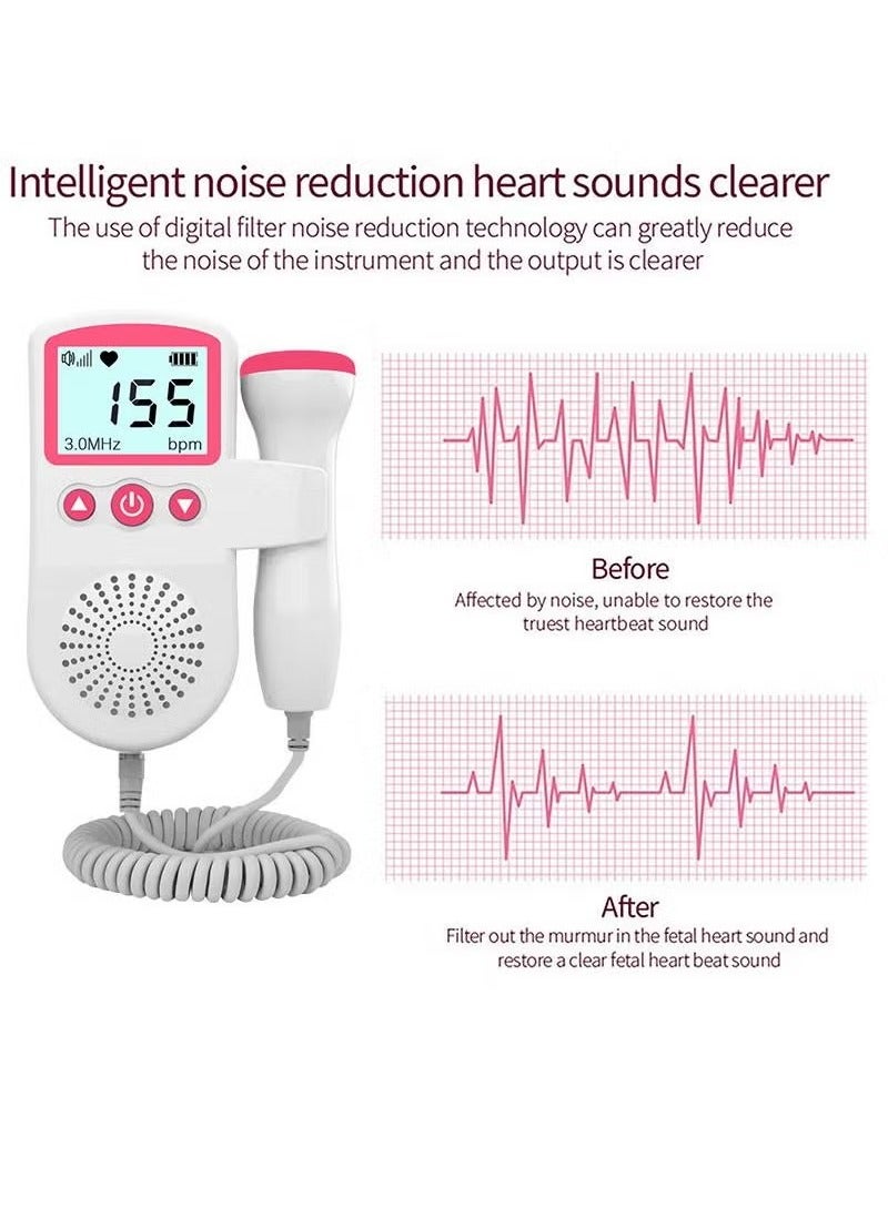 Generic Portable Ultrasound Doppler Fetal Heart Rate Monitor with LCD Screen, High-Sensitivity Probe, Noise Reduction, and Dual Listening Modes  - Image 4